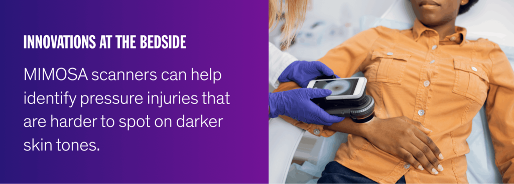 Innovations at the bedside: MIMOSA scanners can help identify pressure injuries that are harder to spot on darker skin tones.